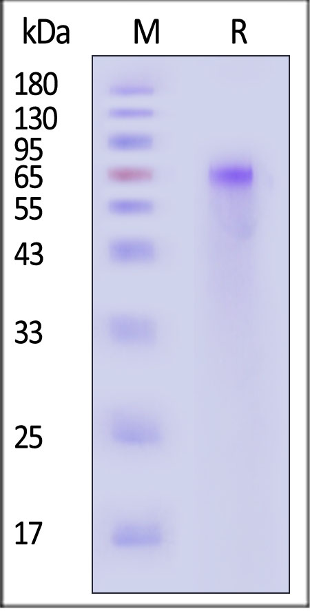 ADAM9 SDS-PAGE