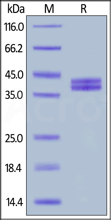 Complement C5a SDS-PAGE