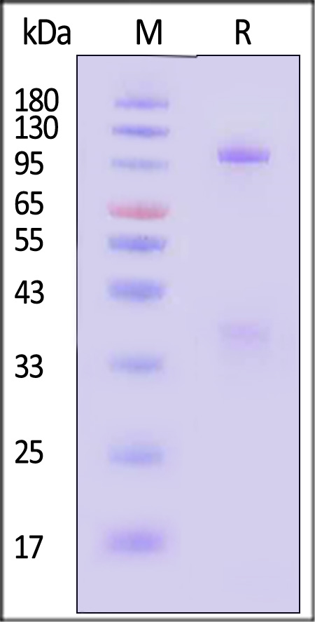 Glycoprotein H & Glycoprotein L/gH & gL (HSV) SDS-PAGE