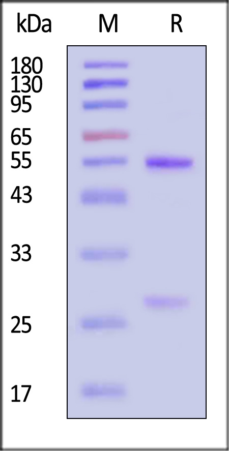 Hemagglutinin/HA (Influenza Virus) SDS-PAGE