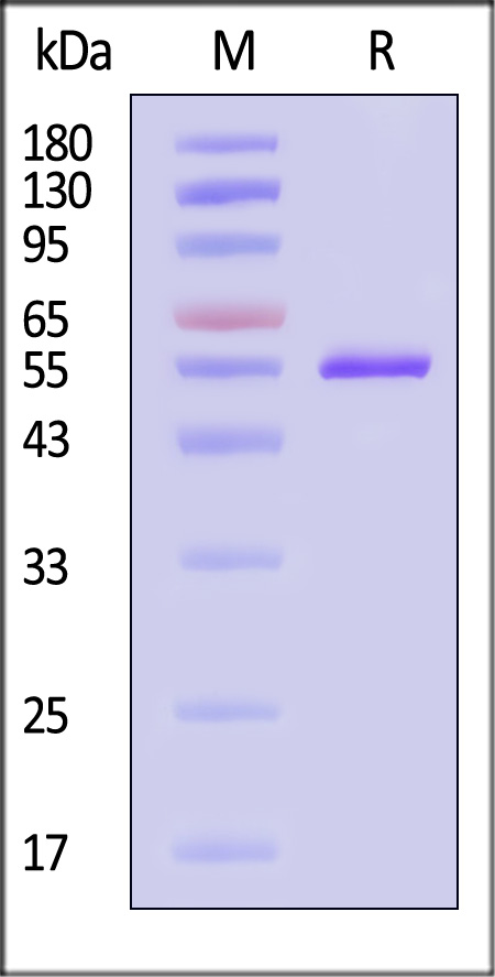 Nucleoprotein SDS-PAGE