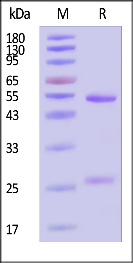 SFTS-Gn SDS-PAGE