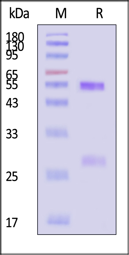 SFTS-Gn SDS-PAGE