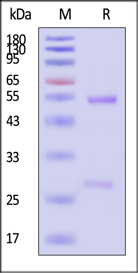 Trastuzumab ADA SDS-PAGE